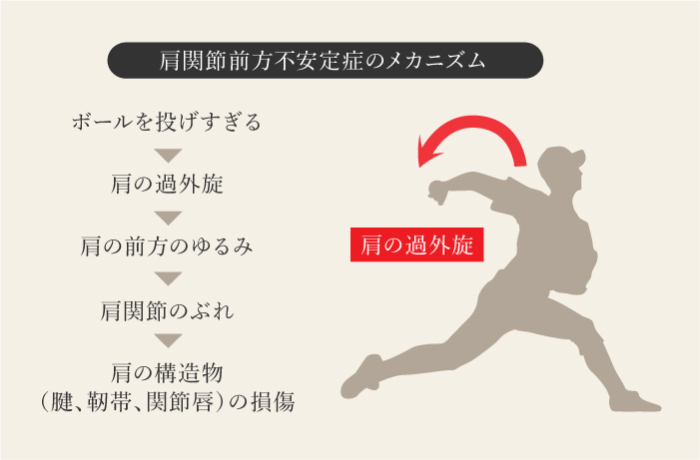 肩関節不安定症